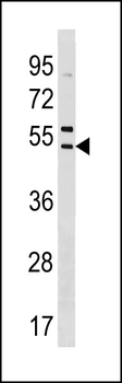 SNX5 Antibody (N-term)