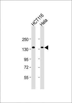 ANKS1A Antibody (N-term)