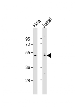 ZNF577 Antibody (N-term)