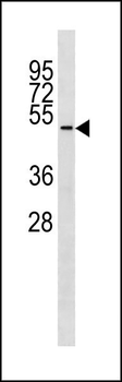 TUBD1 Antibody (C-term)