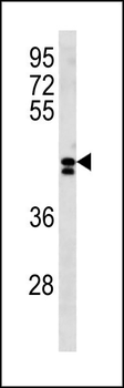 LRRC2 Antibody (N-term)
