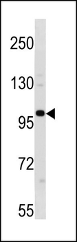ESCO1 Antibody (C-term)