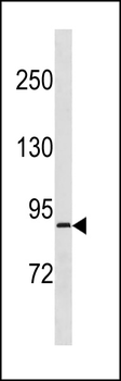 RPS6KA4 Antibody (Center)