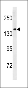 PCDH11Y Antibody (C-term)