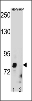 ZMAT1 Antibody (C-term)