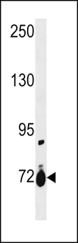 SLC28A1 Antibody (Center)