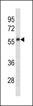 Mouse Plau Antibody (C-term)