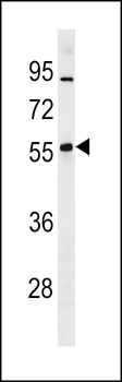 Mouse Znf260 Antibody (N-term)
