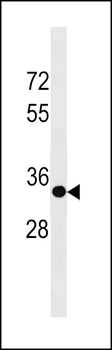 SPRY3 Antibody (C-term)