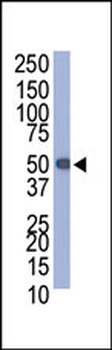 PROC Antibody