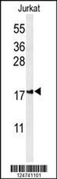 IMP2L Antibody (Center)