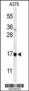 DAZAP2 Antibody (C-term)