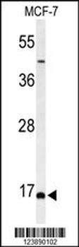 FAM44B Antibody (C-term)