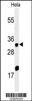 ELOVL5 Antibody (C-term)