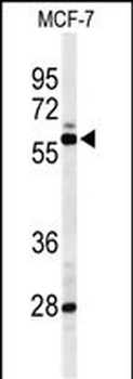 NR1H3 Antibody (Center)