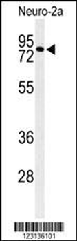 CIRH1A Antibody (N-term)