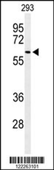 SNX27 Antibody (Center)