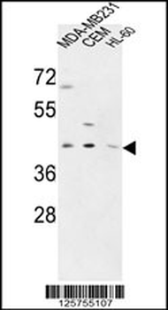 PR38A Antibody (C-term)