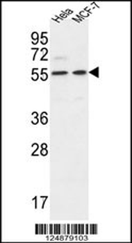 DDX6 Antibody (Center)