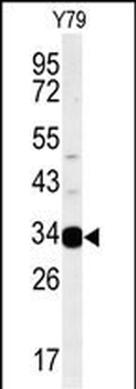AIG1 Antibody (N-term)