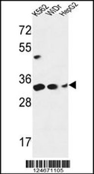 PYCR1 Antibody (C-term)