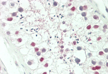 HOXA3 Antibody (C-term)