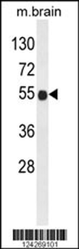 B3GNT6 Antibody (Center)