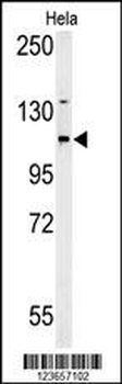 ADCY4 Antibody (Center)