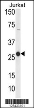 CD160 Antibody (Center)