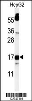TYROBP Antibody (C-term)