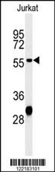 HADHB Antibody (C-term)