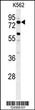 ACBG2 Antibody (Center)