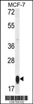 RT25 Antibody (C-term)