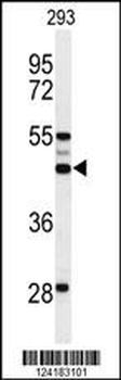 OST alpha Antibody (C-term)