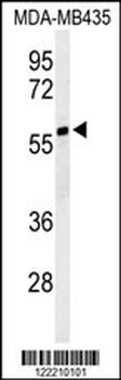 NARFL Antibody (Center)