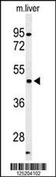 hPFTK1-M1 Antibody