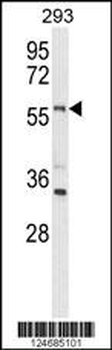 LMBR1L Antibody (C-term)