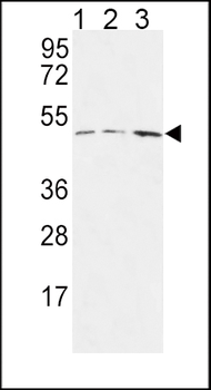HAPLN1 Antibody (N-term)