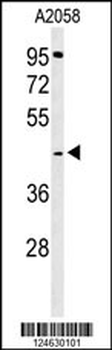 GPSN2 Antibody (C-term)