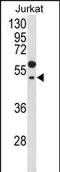 GNAT1 Antibody (C-term)