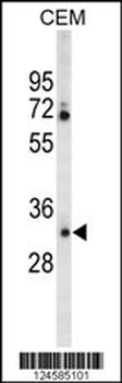CA6 Antibody (C-term)