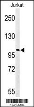 PKHH2 Antibody (C-term)