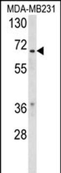 RXRB Antibody (Center)