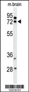HSPA12A Antibody (Center)