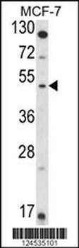 HSD11B2 Antibody (Center)
