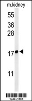 LYPD1 Antibody (C-term)