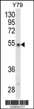 P2R3C Antibody (N-term)