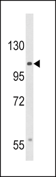 CACNA2D3 Antibody (C-term)