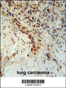 DCLRE1C Antibody (N-term)