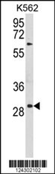 UPK1B Antibody (Center)